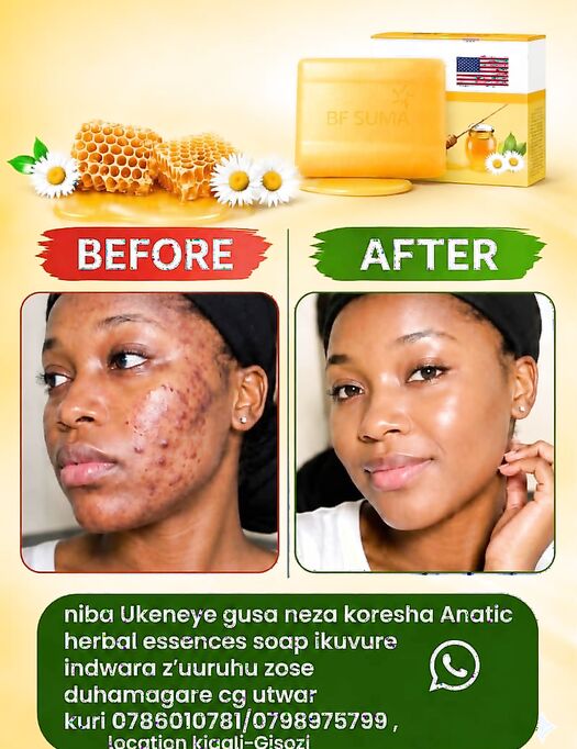 Anatic Soap